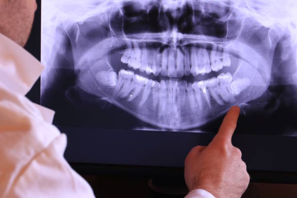Best Emergency Root Canal Treatment in Lawrenceburg, KY